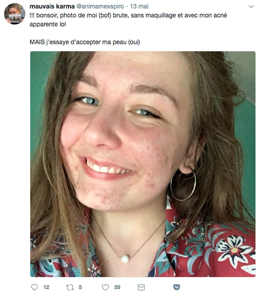 Publication publique sur Twitter représentant une jeune femme assumant avec un selfie la peau de son visage, et publication publique sur Facebook représentant un ventre avec vergetures